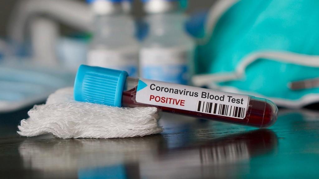 عاجل | وزير الصحة: ارتفاع عدد الإصابات بفيروس كورونا في المملكة إلى 19 . 